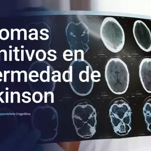 Síntomas cognitivos en enfermedad de Parkinson